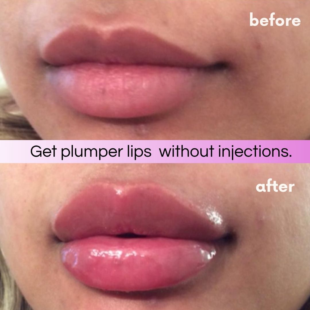 Instant filler lips plumper